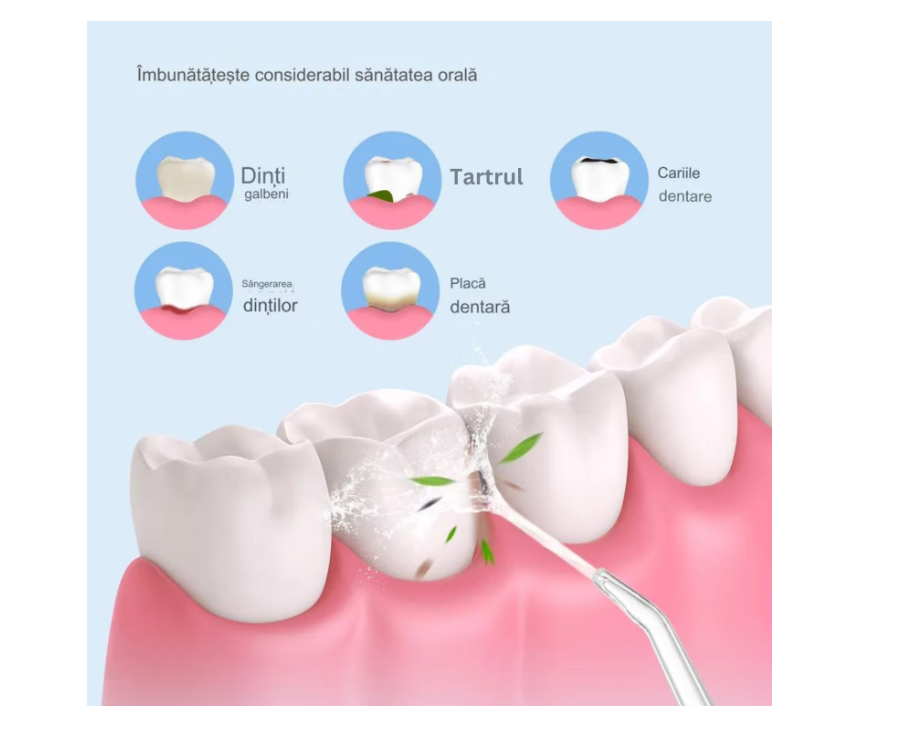 Irigator Oral Portabil, 3 Moduri de Jet (Soft, Normal, Pulse), Rezervor 230ml, 4 Duze, Incarcare USB, Impermeabil IPX7, Ideal pentru Igiena Dentara Zilnica,